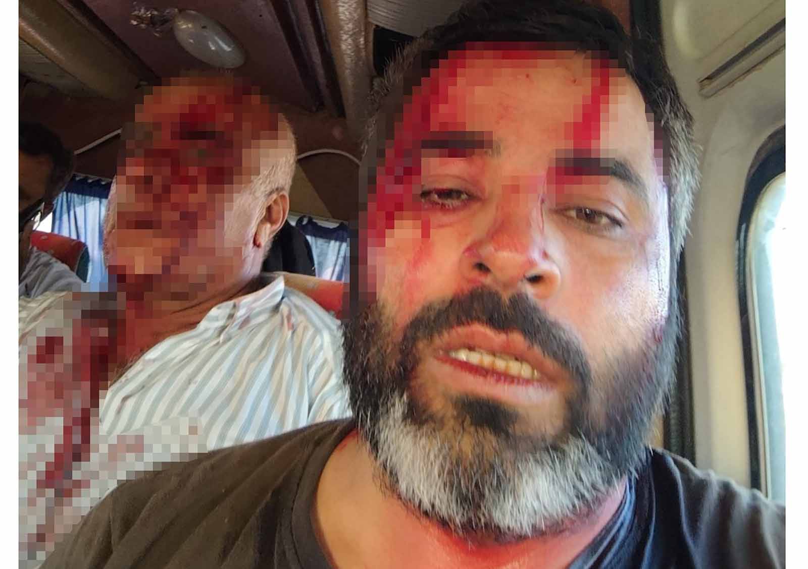 Akçakale’de meydan savaşı gibi kavga
