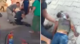 Konteynerde çıkan yangında küçük çocuk ağır yaralandı